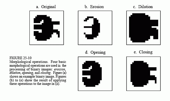 morphological operations on binary image matlab code