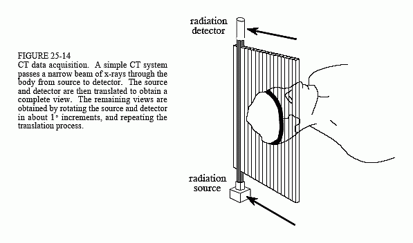 computed tomography