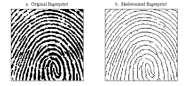 [Figure 25-11]